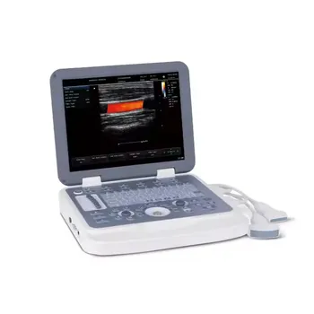 JZ-ADU80C Electric Hospital Doppler Color Ultrasound Scanner for Pregnancy Medical Ultrasonic Instruments Diagnostic Purposes