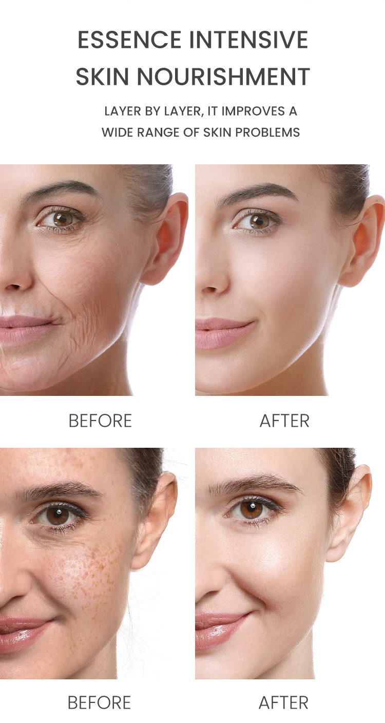 Wholesale ESTELIN Skin Care Brightening Vitamin C Turmeric Face Serum 30ml