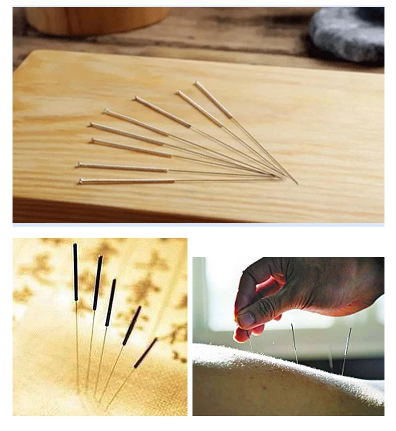 Free Sample Tubeguided Handle Sterile Acupuncture Needles Buy