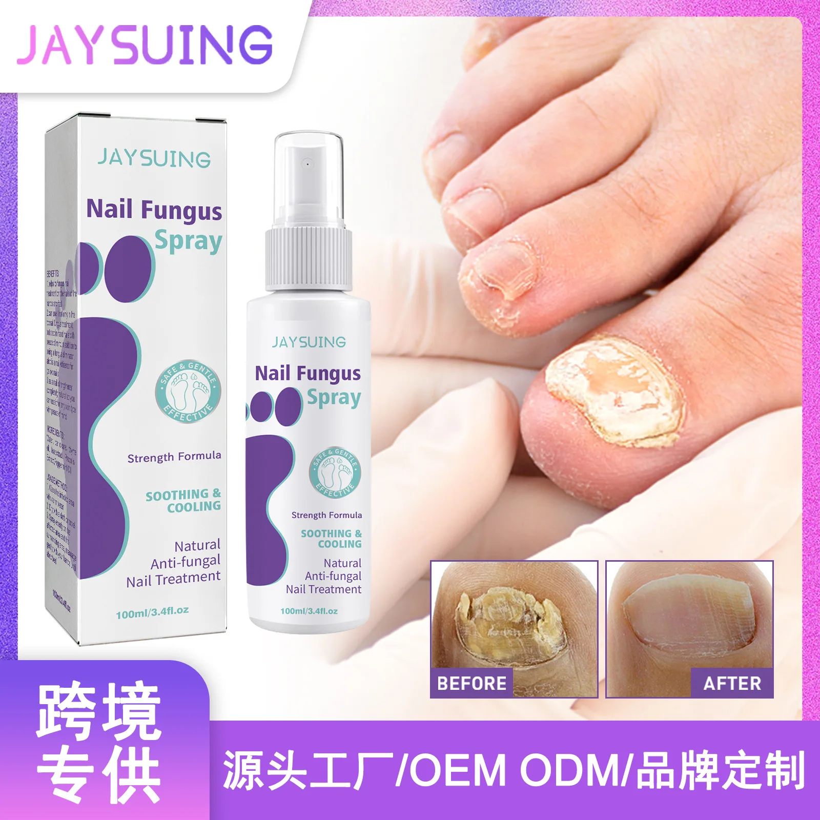 JAYSUING Nail Fungus Products 7 Days Nail Fungus Treatment Spray 100ml