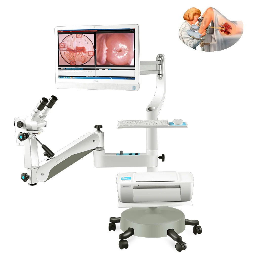 Kernel Best Optical Colposcope Illuminated Gynecological Examination Vulva Vagina Cervix 6.37 HD Camera 5-Step Magnification