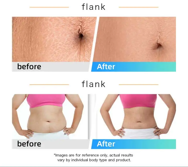 Professional 448KHZ Skin Tightening Portable Fat Burning Massage Body Slimming Shaping Machine Wrinkle Removal Machine