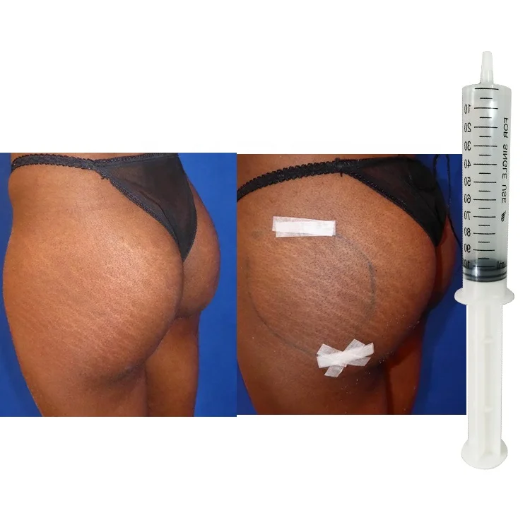 Wholesale factory 100ml breast filler injection buttocks enlargement HA filler