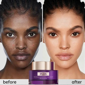 Calantha Niacinamide Arbutin Vitamin Anti-Aging Pimples Melasma Blemish Dark Spot Remover Cream 50g Strong Bleaching Whitening