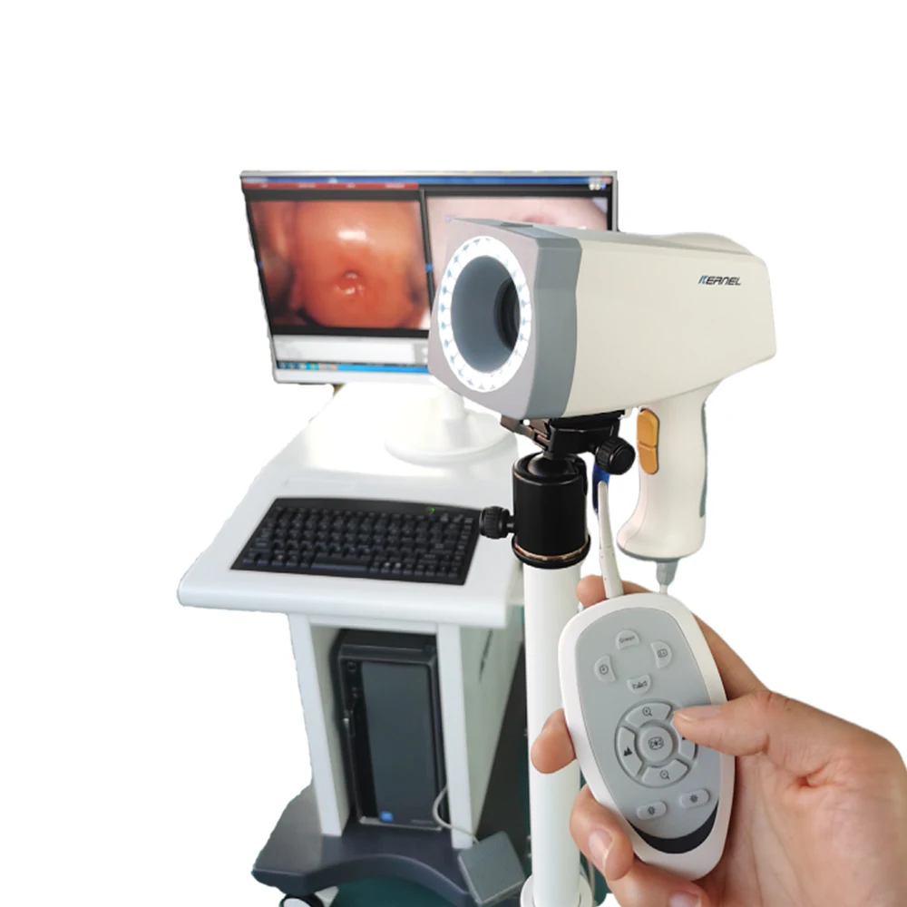 CE Cleared Digital Video Colposcope with Powerful Software Medical Mobile HD Digital Video Colposcope for Gynecology KN-2200