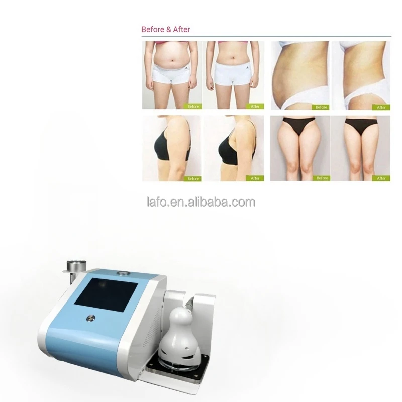 2024 trending products cellulite removal Body Weight Loss Reduce Inner Ball Roller Body Contouring Machine with EMS
