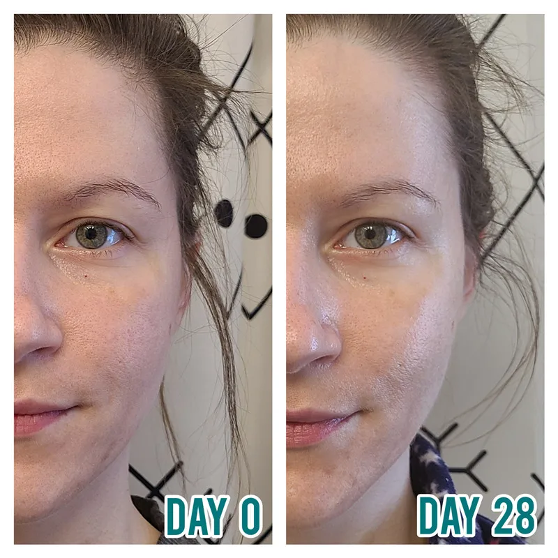ghk-cu before and after photos Peptide Therapy in Raleigh, NC ZS Factory Price 99% Ghk-Cu