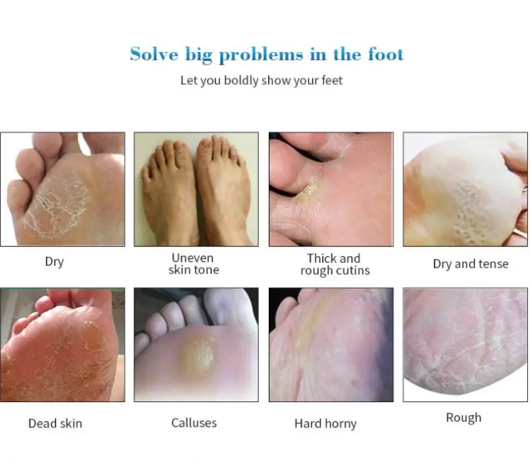 Отшелушивающая маска для