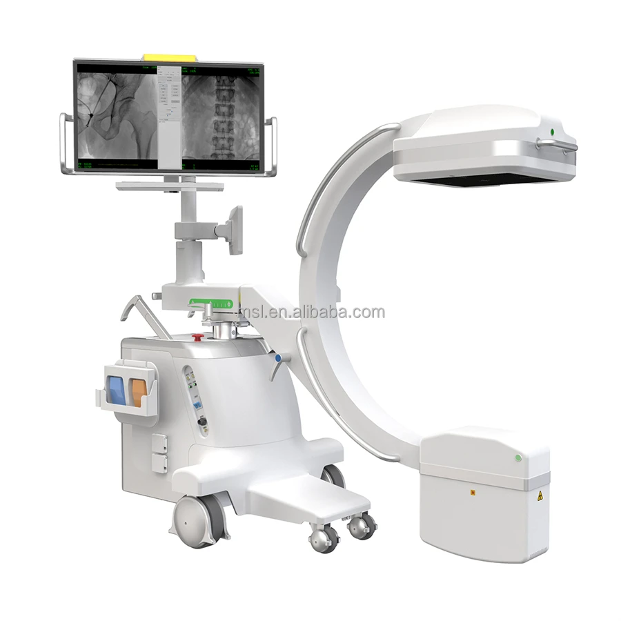 100ma C Arm X Ray Machine Price/ Radiology Scanner C Arm Fluoroscopy Machine Buy C Arm