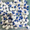 Forme des globes oculaires