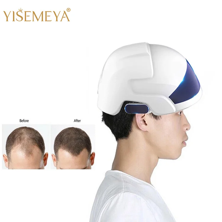 Hair Growth Helmet Hair Growth Helmet Lllt 650nm Led Light 30 Diode 26 Lasers Hair Growth Helmet Buy Hair Growth Helmet Lasers Hair Growth Laser Hair Growth Product On Alibaba Com