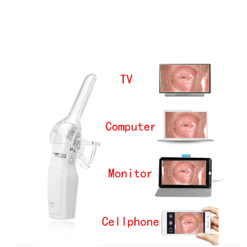 Protable digital colposcope mini hand held Self-test colposcopy
