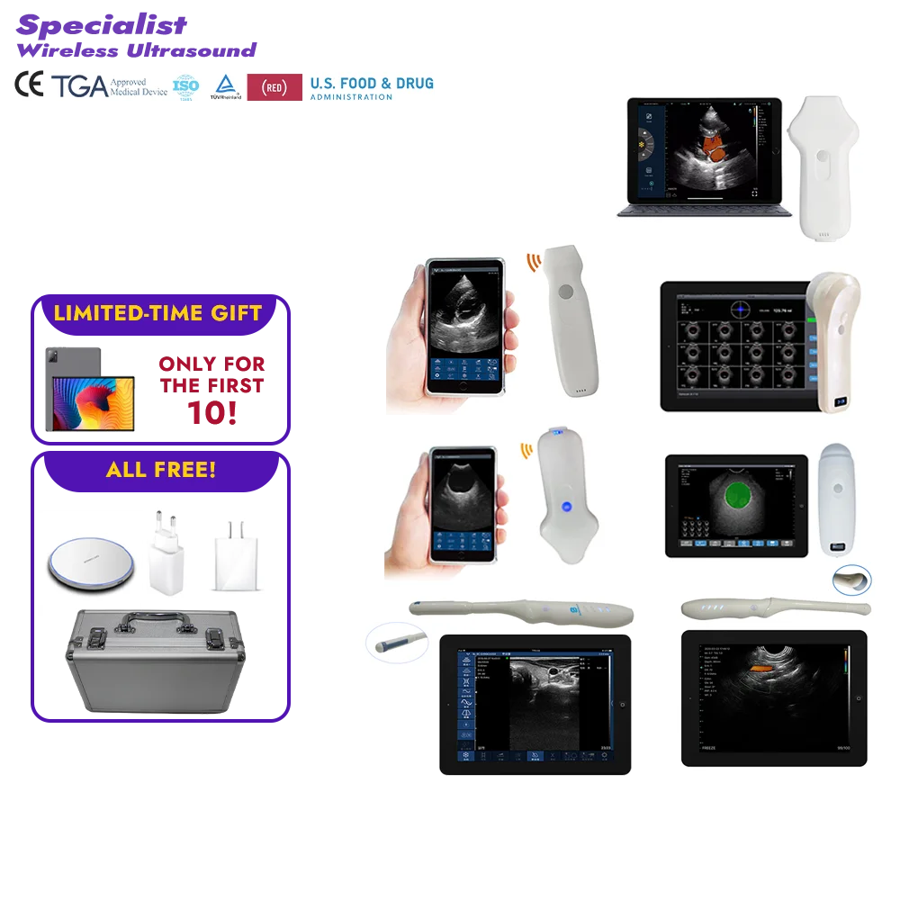 Suresult Wireless Ultrasound With Screen For Veterinary Use - Buy Vscan ...