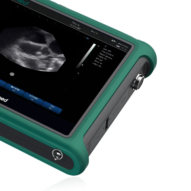 Yonker Factory Price Veterinary Ultrasound Machine Veterinary Ultrasound Portable Xuzhou Veterinary Ultrasound