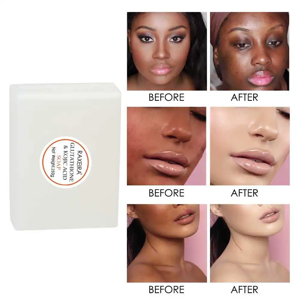 Private Label Kojic Acid Soap Dark Black Skin Lightening Hand Made Soap Glutathione Whitening Brighten Face Soap Private Label Kojic Acid Soap Dark Black Skin Lightening Hand Made Soap Glutathione Whitening Brighten Face Soap