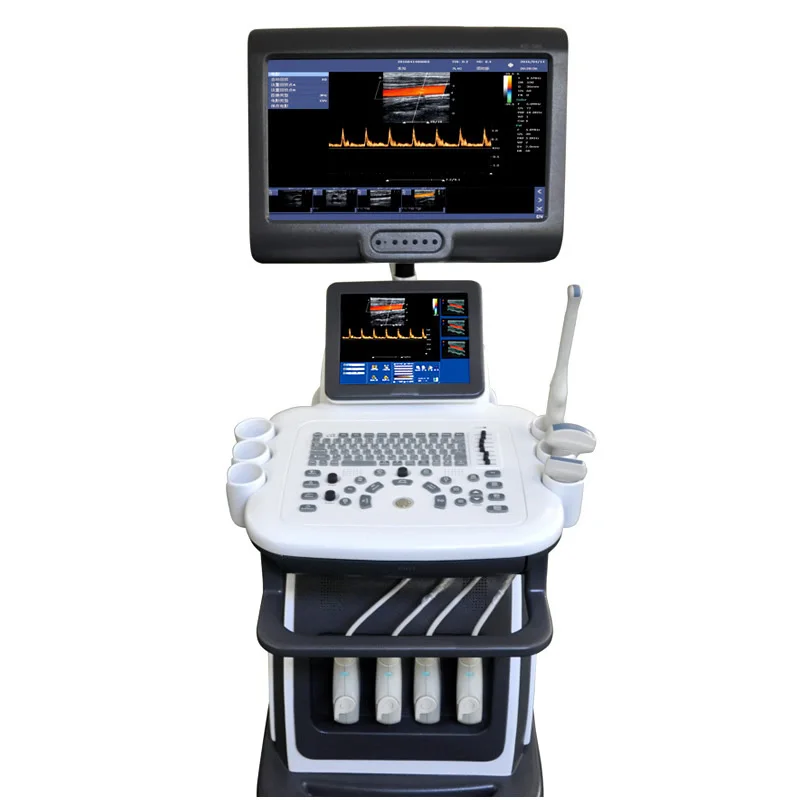 New Arrival High-end 3D 4D Color Doppler Cardiac Diagnostic Ultrasound Machine-121050