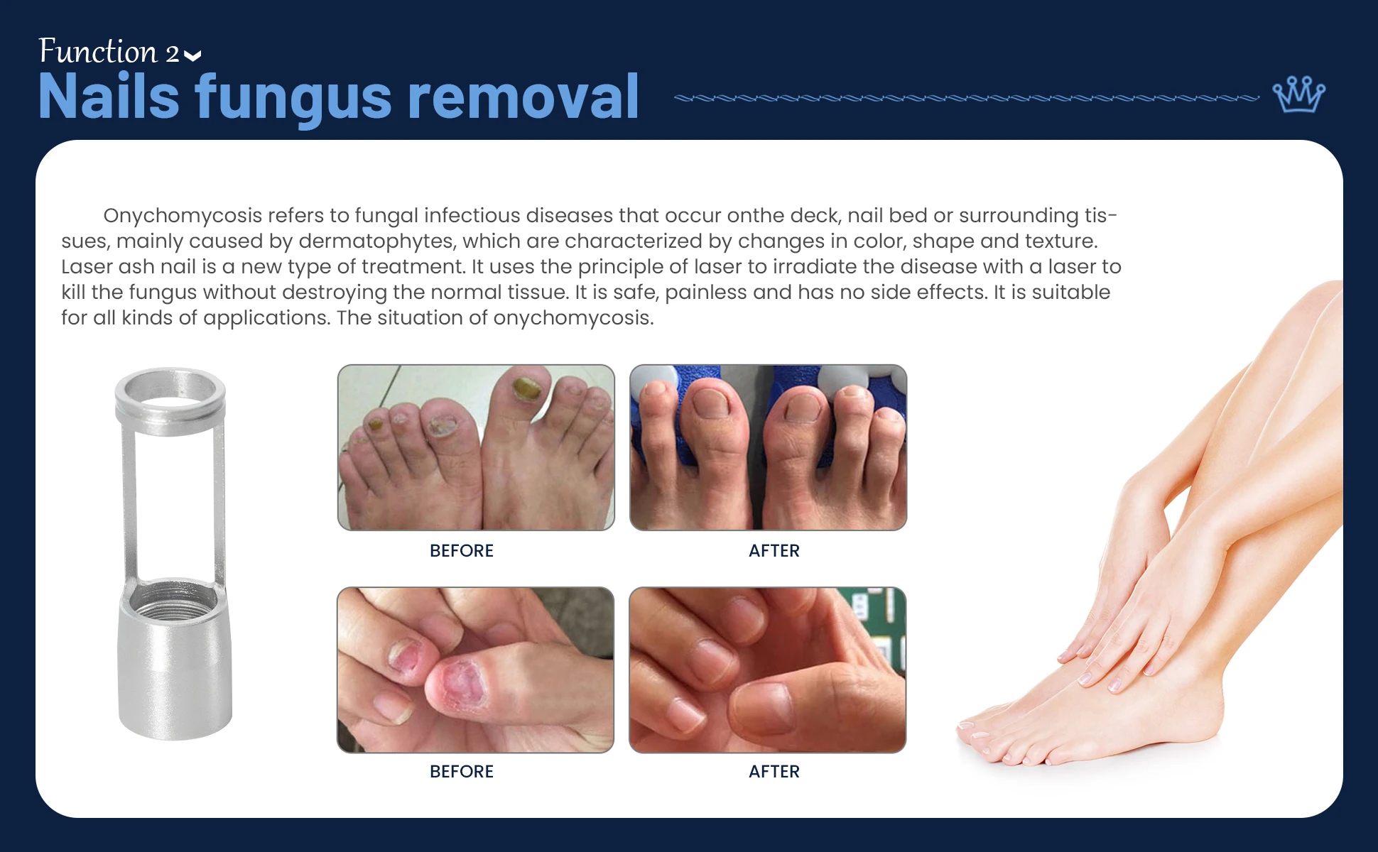 Nail Care