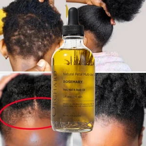Private Label Best Rosemary Oil Products Deeply Nourishing the Scalp and Repairing Hair Follicles Hair Growth Essential Oil