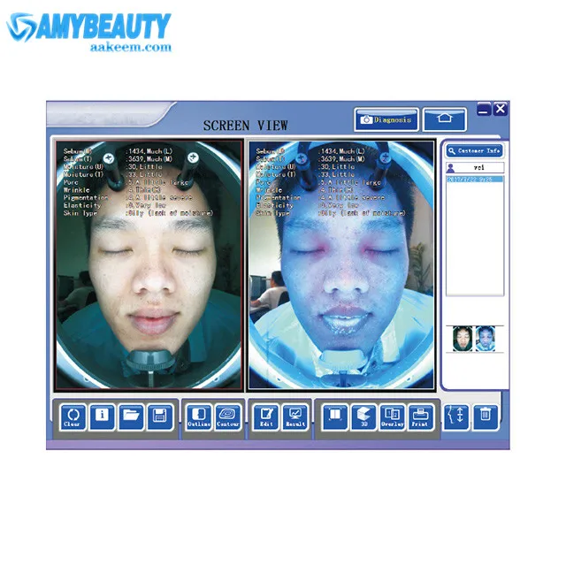 Skin Hydration Analyzer Image Software  Analysis Imagery Skin Scanner Beauty Camera test Machine Skin Face Analyser