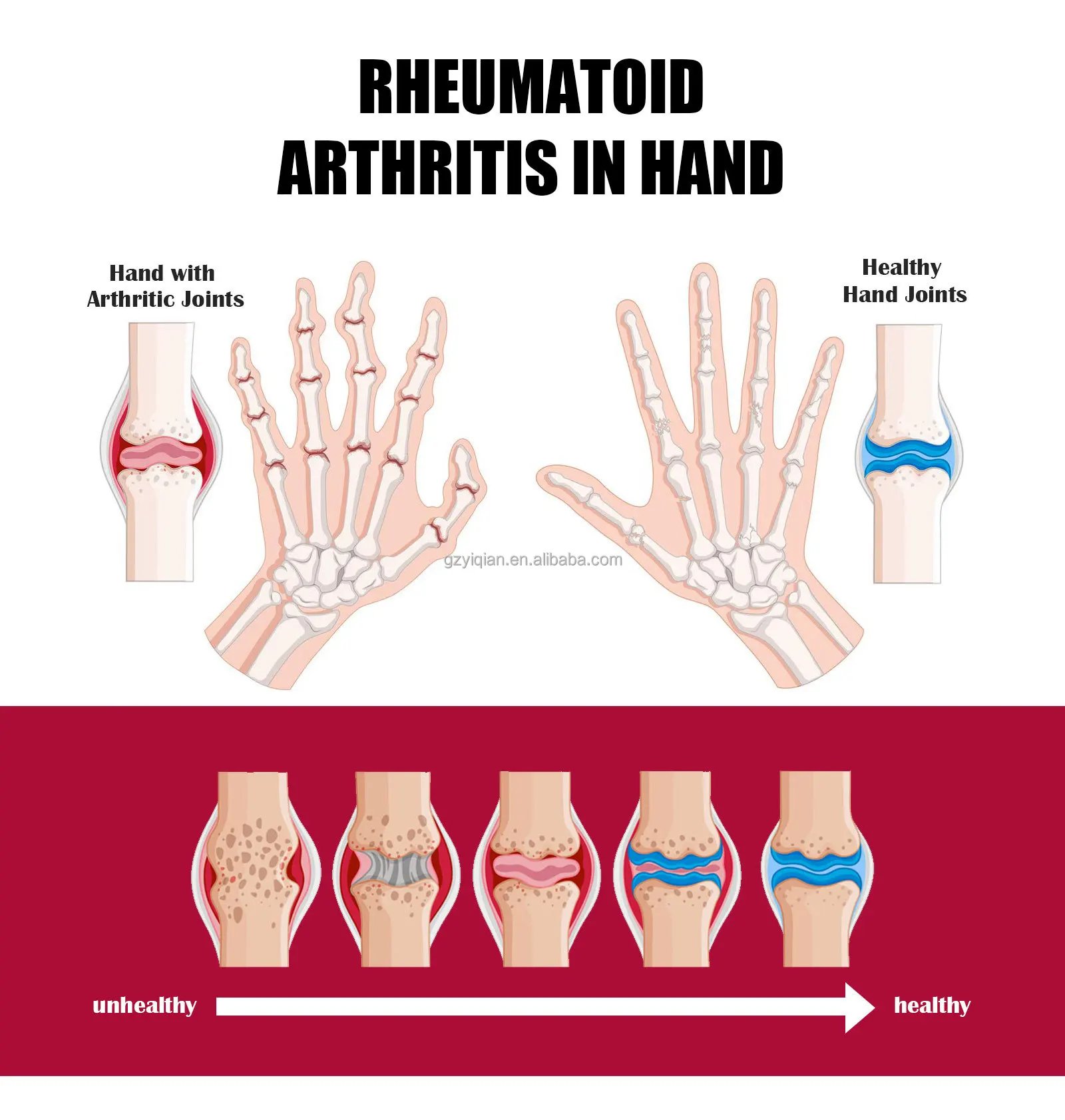 Collagen Vitamin D3+k2 Joint & Bone Therapy Cream Pain Relief Cream