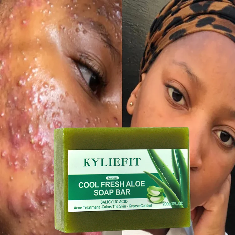 Salicylsure Khlende Aloe-Seife Porenreinigung Peeling Aknebekmpfung  Hautpflege-Seife zur Hautglttung und gegen Unreinheiten