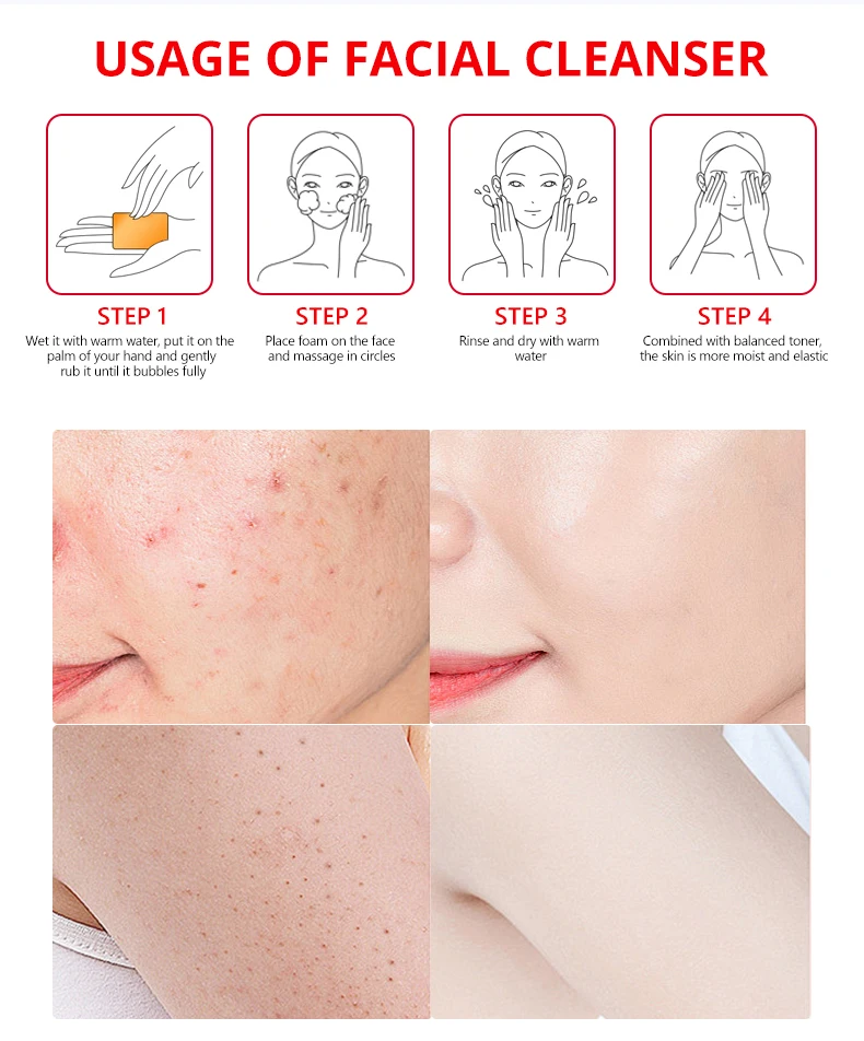 120g Kojic Acid & Carrot Body Bath Soaps Clear Skin Product Moisturizing Fair Skin Face and Body Bar Soap
