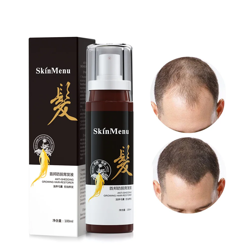 Органический спрей для роста волос, эфирные масла для стимулирования роста волос