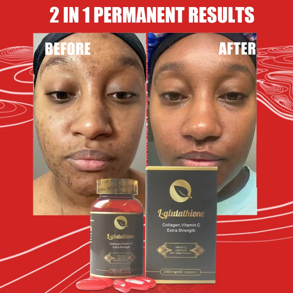 glutathione eclaircissant gelules Glutathion : quels sont les bienfaits de cet antioxydant ?