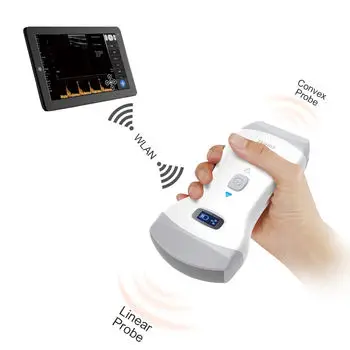 Wholesale Cheap Handheld Portable Ultrasound Wireless Ultrasound Machine Veterinary Monitoring Device with Competitive Price