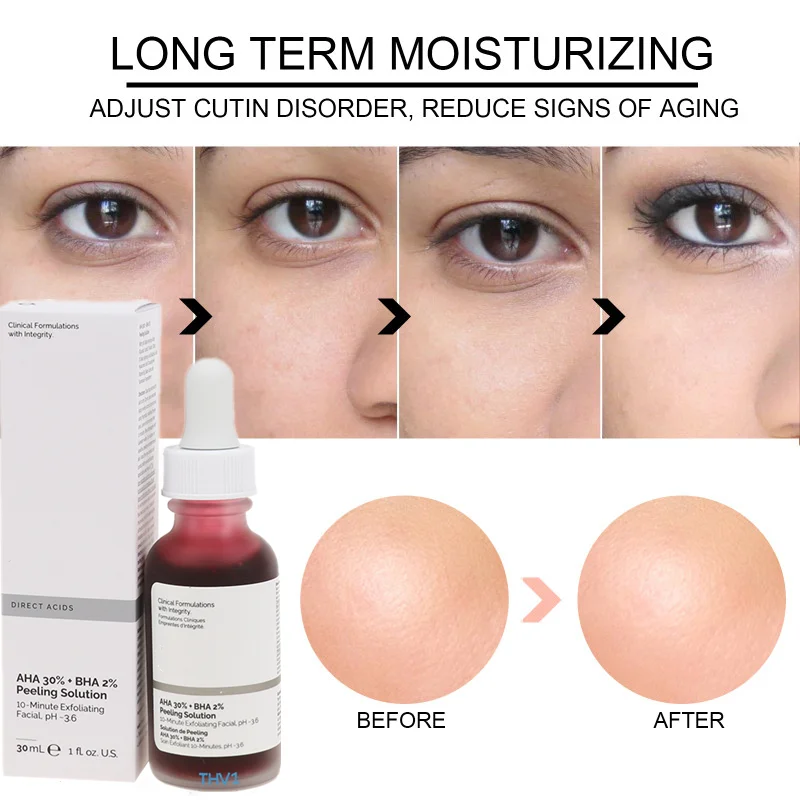 Niacinamide 10 Zinc 1 Hyaluronic Acid B5 Aha Peeling Buffet Lactic