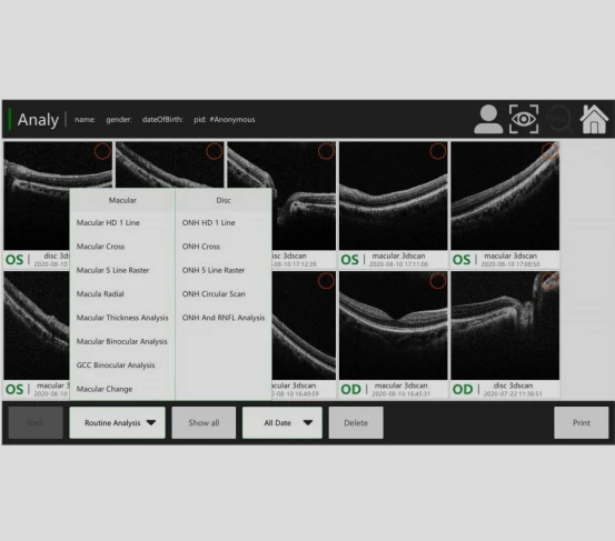 China Professional Ophthalmic OCT-500 with 13.3 Inch Touch Screen