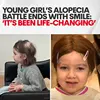 prima e dopo