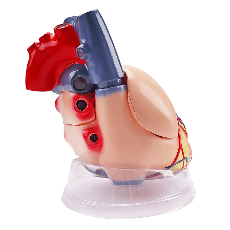 
 Модель человеческого сердца 5 раз с прозрачным нижним цветом медицинская Кардиология Анатомия обучающая модель  