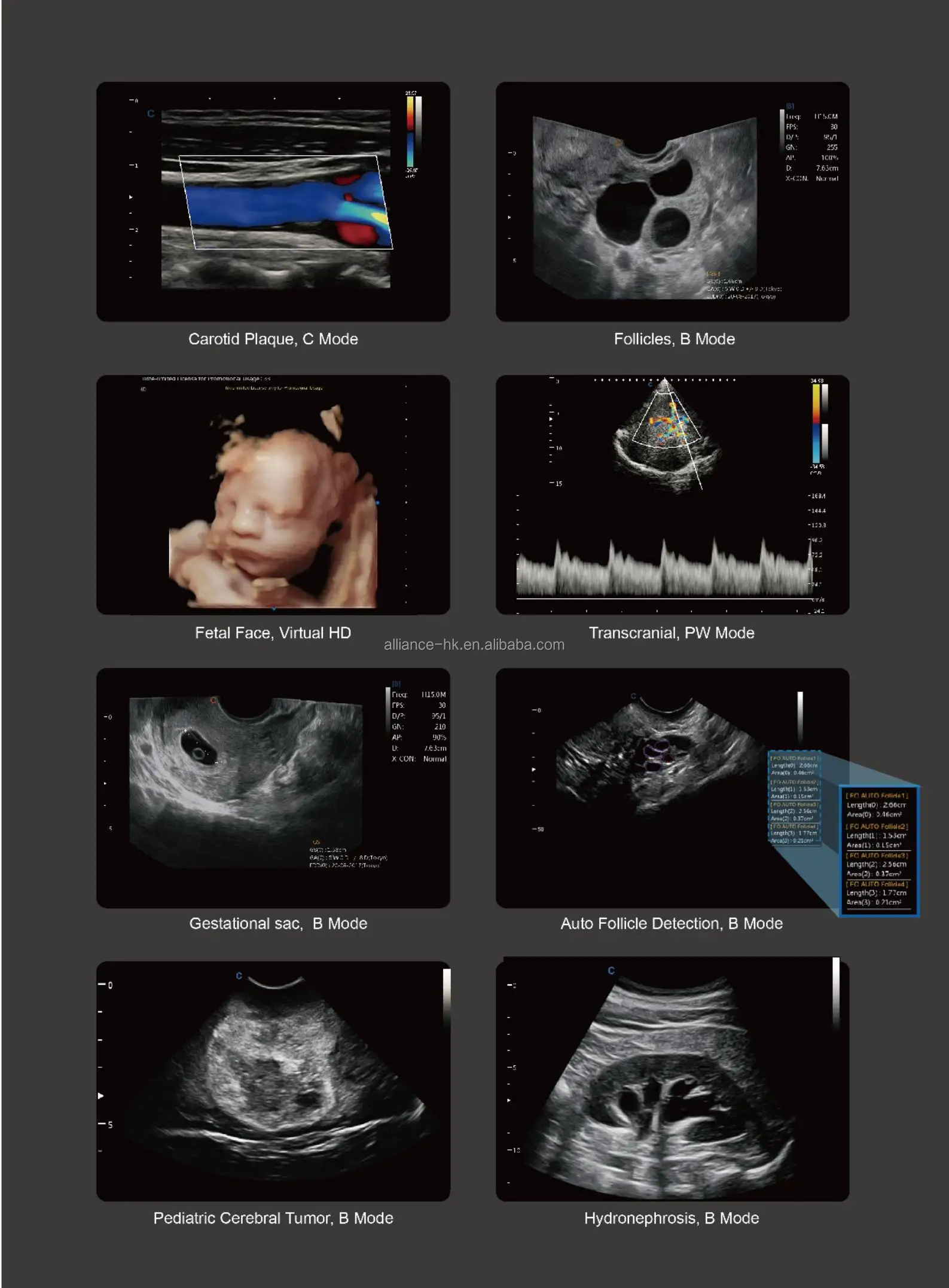 CBit4 catalogue_06.jpg
