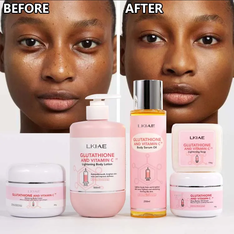 glutathione soap and lotion Glutathione Niacinamide Body Lotion Bundle Set main image 0