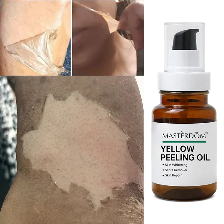 Oem African Extra Strong Bleaching Oil,Dard Skin Dark Knees Knuckles