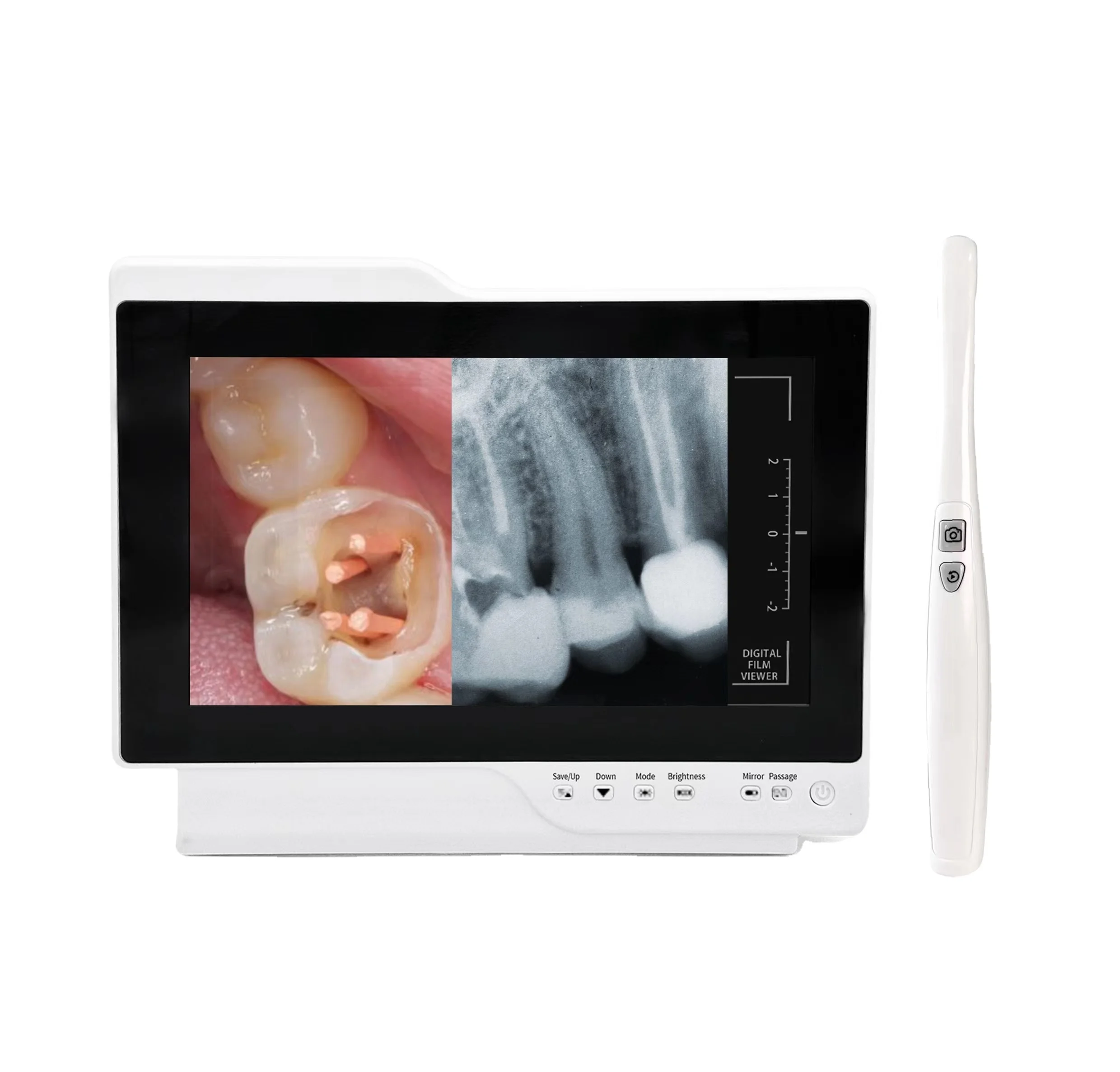 Intelligent Oral Observation Instrument Dental New Equipment Intraoral camera