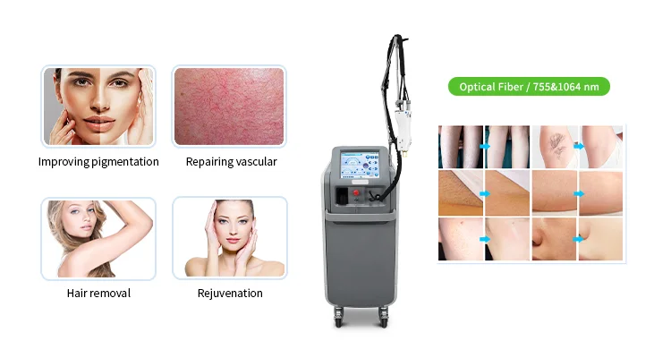 Advanced dual-wavelength Alexandrite 755nm and Nd:YAG 1064nm long-pulse laser hair removal machine designed for medical spas and dermatology clinics. High-power output, intelligent cooling, and multi-spot technology deliver fast, safe, and effective treatments for all skin types. alexandrite laser hair removal machine, 755nm alexandrite laser, 1064nm nd yag laser hair removal, long pulse alexandrite nd yag laser, professional hair removal device, medical spa laser machine, clinic grade hair removal system Professional 755nm Alexandrite + 1064nm Nd:YAG Laser Hair Removal System