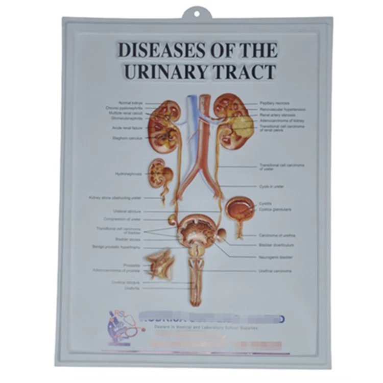 Оптовая продажа медицинских плакатов для обучения человеческой мускулатуры, 3d тисненые медицинские плакаты