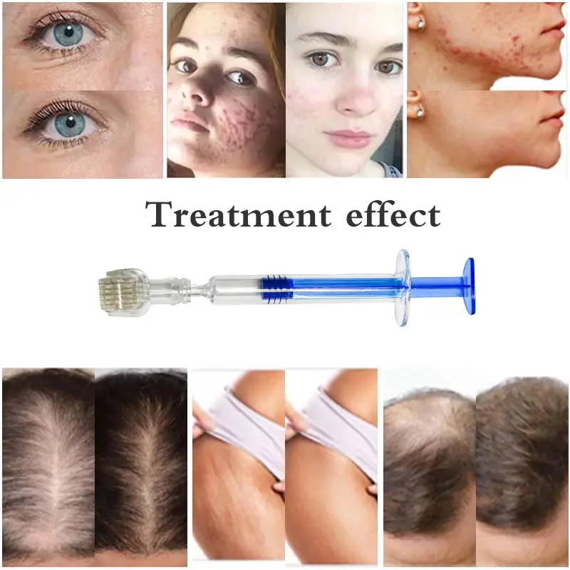 Новинка мезотерапия Aqua Derma Roller в ампулах шприц для мезотерапии сыворотка-аппликатор ухода за