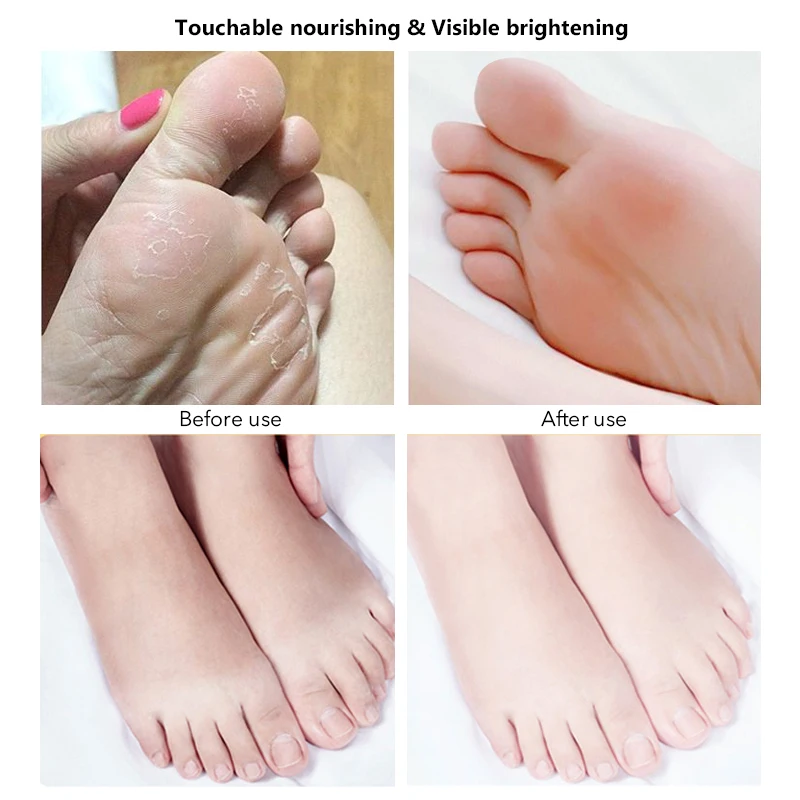 private label foot peal mask