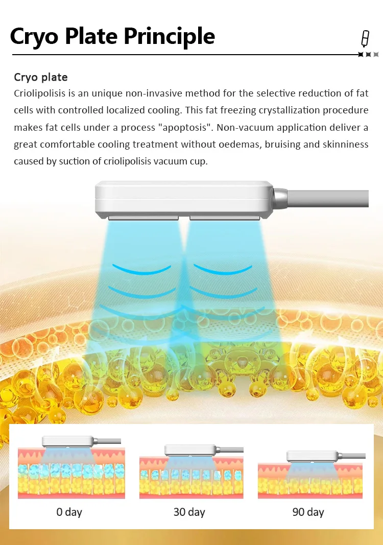 Cryolipolysis Machine with 8 Cryo Paddles for Fat Reduction & Body Sculpting 7 Discover the professional Cryolipolysis Machine with 8 Cryo Paddles for non-invasive fat freezing, body contouring, slimming, and salon body sculpting treatments. Designed for aesthetic clinics, med spas, and beauty salons seeking advanced multi-handle cryotherapy technology. Cryolipolysis Machine with 8 Cryo Paddles for Fat Reduction & Body Sculpting