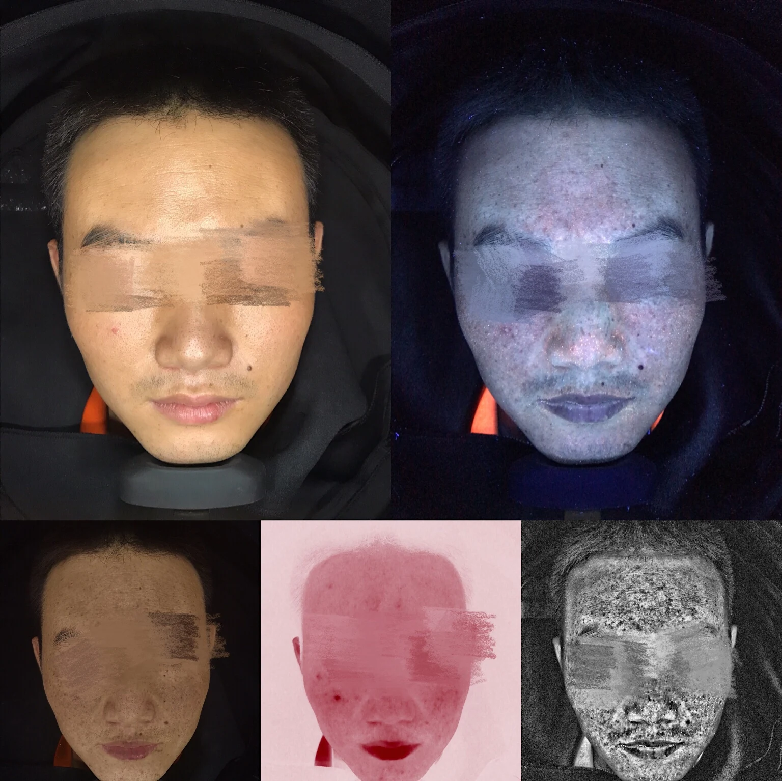 マジックミラーマックスフェイシャルスキャン分析機 Portable Facial Skin Analyzer & Scanner Machine for Face
