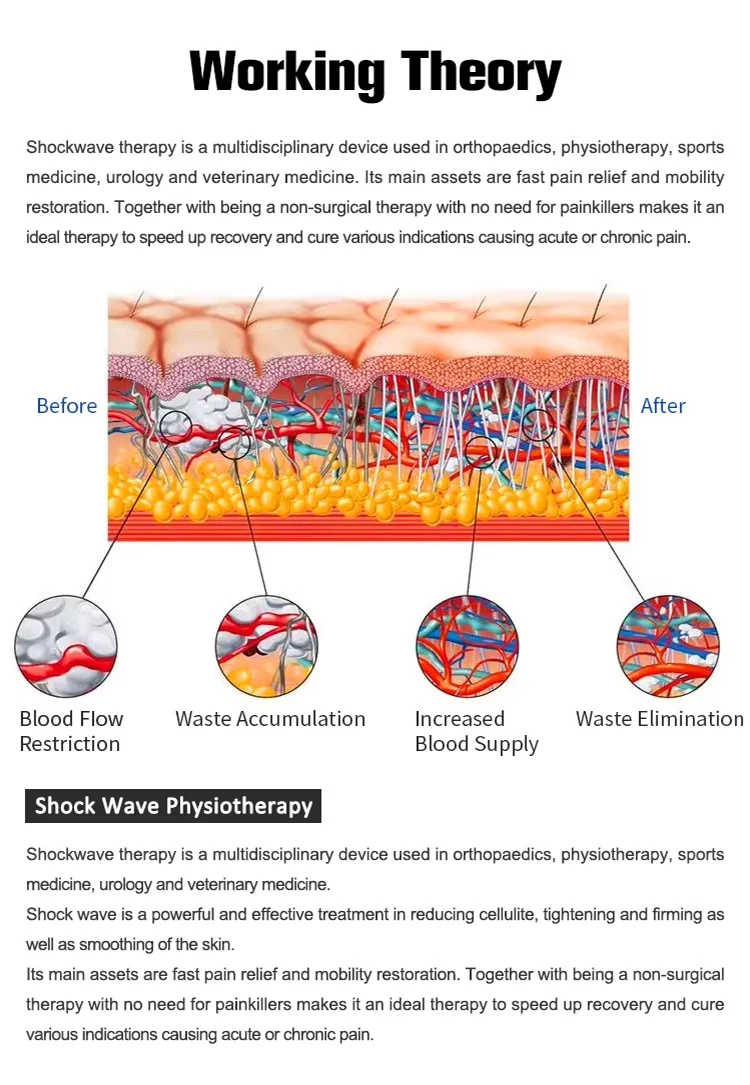 2025 Hot Selling Vibration Massage Weight Loss Electric Body Shaping Slimming Anti Cellulite With Vacuum Machine