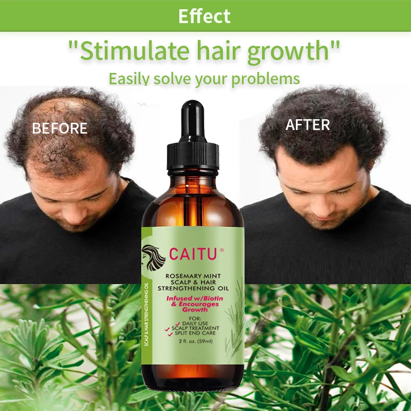 Hotsell 4c Hair Growth Oil Organic Rosemary Oil Hair Growth Hair