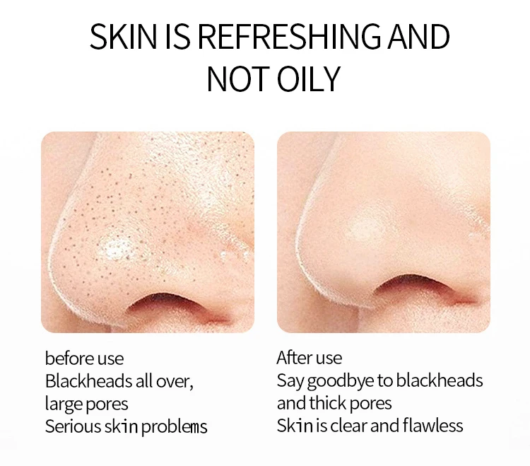 Dr.Rashel Deep Cleansing Charcoal Face Black Soap Oil Control Acne Tighten Pore Whitening Soap