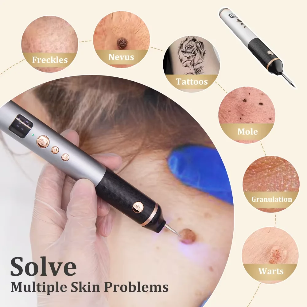 15-Level Painless Plasma Pen Cauterizer Tag Removal Electrocautery Skin Eraser for Face Wart Papilloma Mole Pen