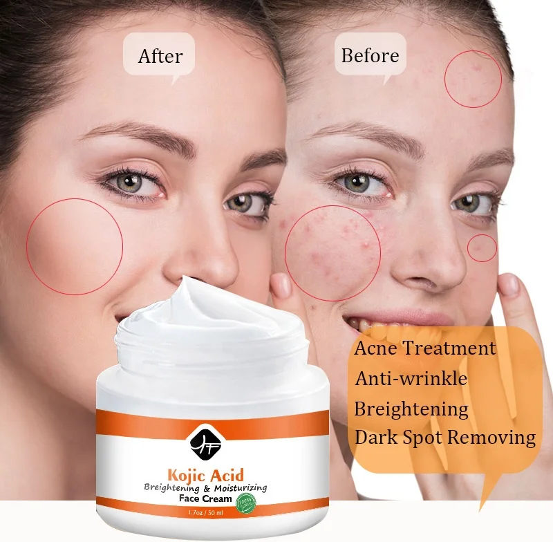 Allwin PRO INC - Kojic Acid Face Cream Anti Aging Wrinkle