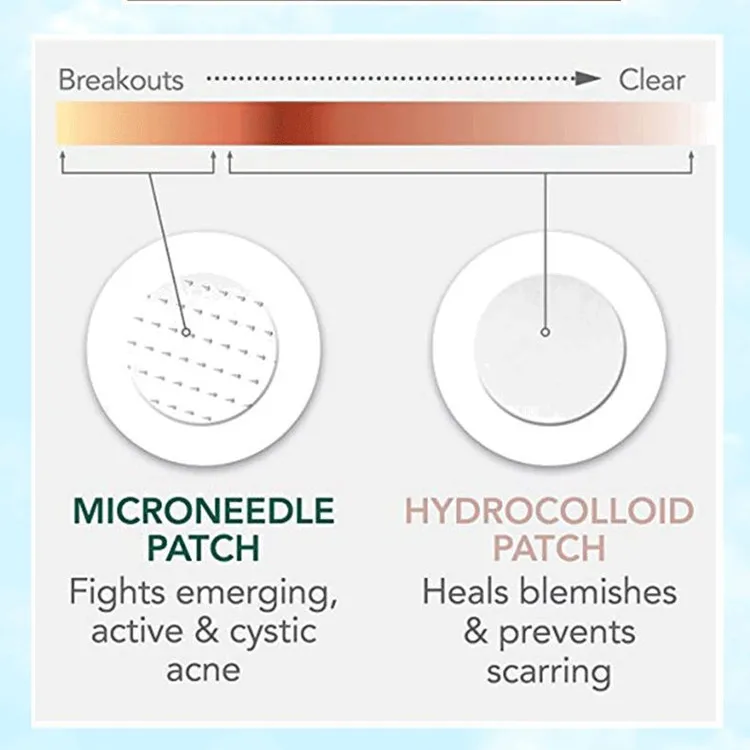 Private Label Micro Point Acne Patches for Face Acne Treatment Anti Acne Patch Spot Remover Microdart Pimple Patch