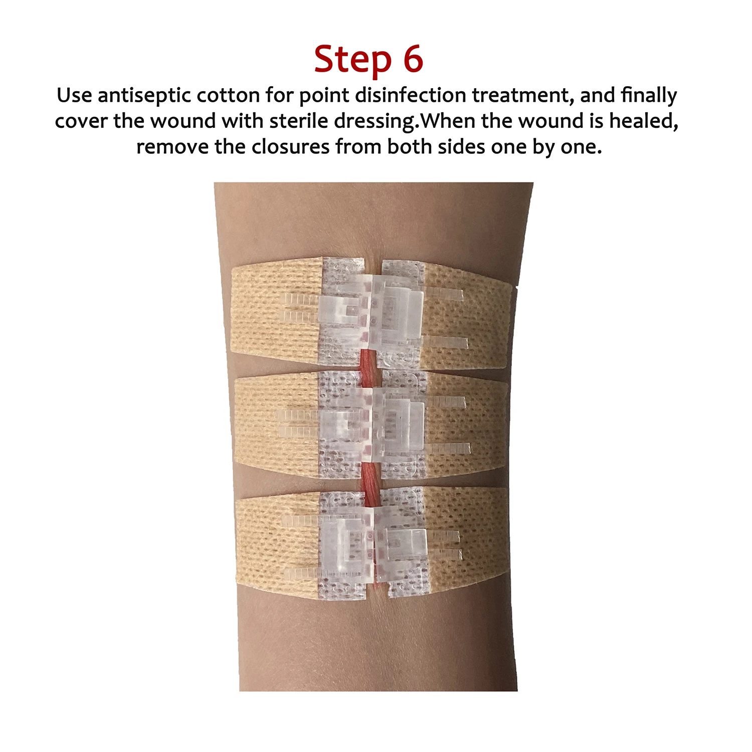 2021-hot-sales-seamless-tape-wound-closure-device-wound-dressing